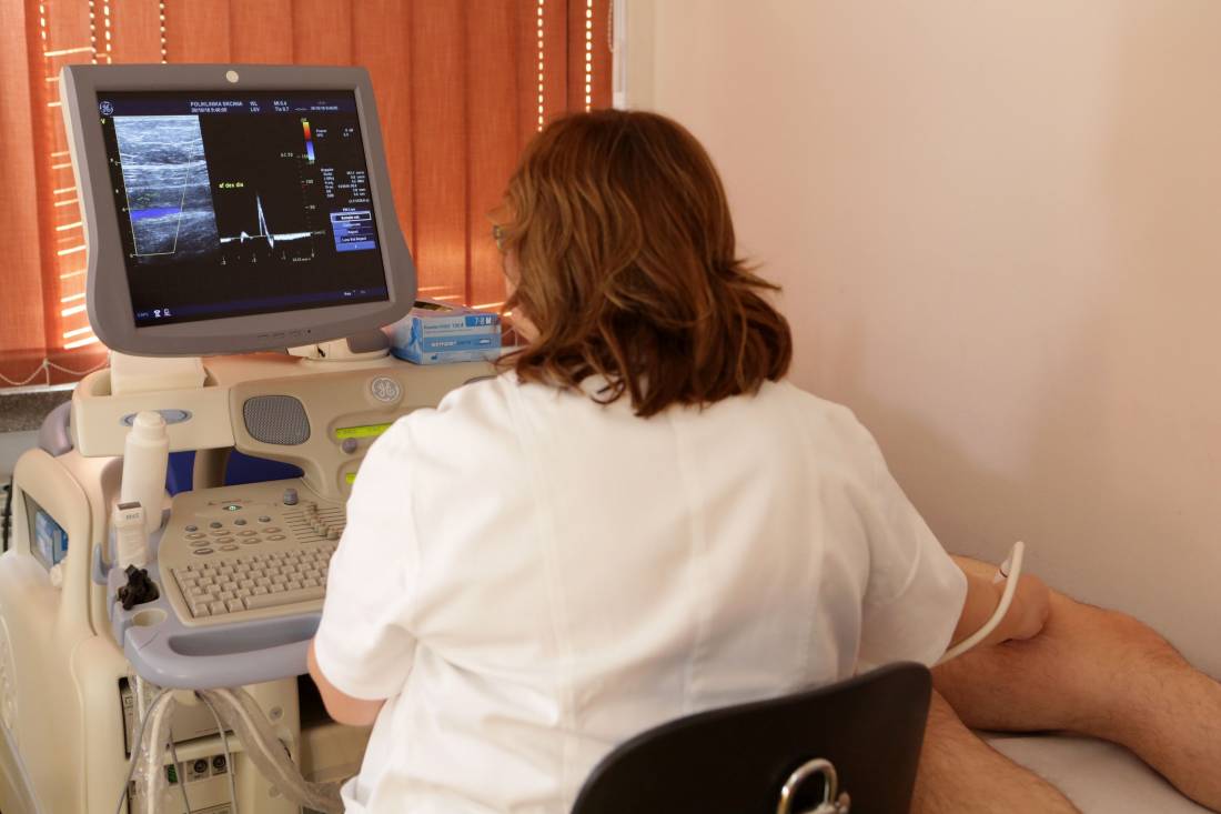 Doppler arterija/vena donjih ekstremiteta