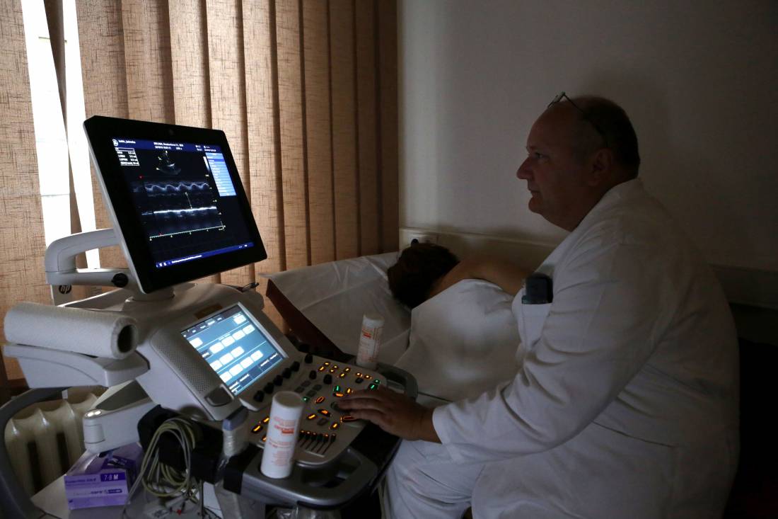 Ultrazvuk srca (Ehokardiografija)