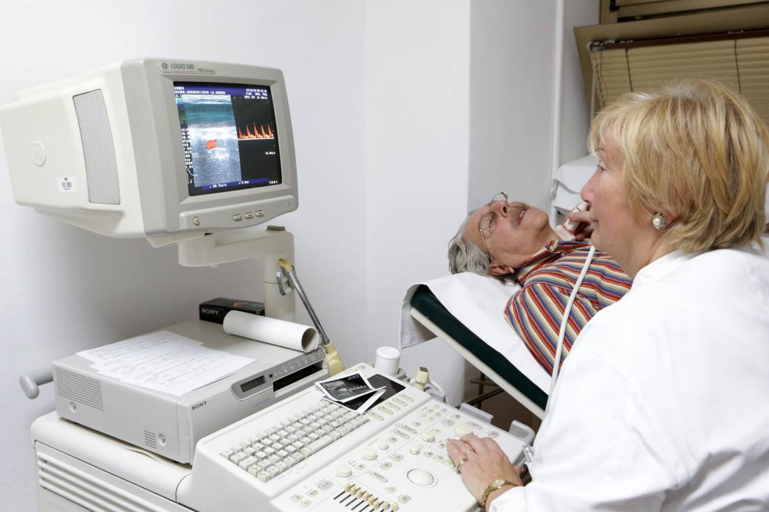 Doppler karotida i TCD VB sliva